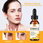 Vitamin C & Hyaluronic Acid Brightening Serum – 30 ml Moisturizing Anti-Aging Essence