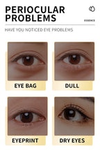 Snail Collagen Face Cream – Anti-Aging, Whitening & Dark Circle Removal Eye Serum